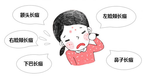 全医堂,祛痘,成都