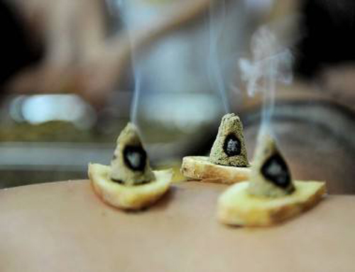 三伏贴,三伏灸,冬病夏治,全医堂 三伏贴,三伏灸,冬病夏治,全医堂