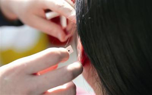 耳穴疗法,全医堂 耳穴疗法,全医堂