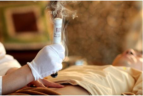 脐灸,中医养生 脐灸,中医养生