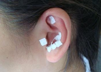 落枕,夏季养生,全医堂 落枕,夏季养生,全医堂