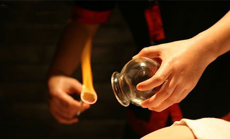 拔罐,中医理疗,全医堂 拔罐,中医理疗,全医堂