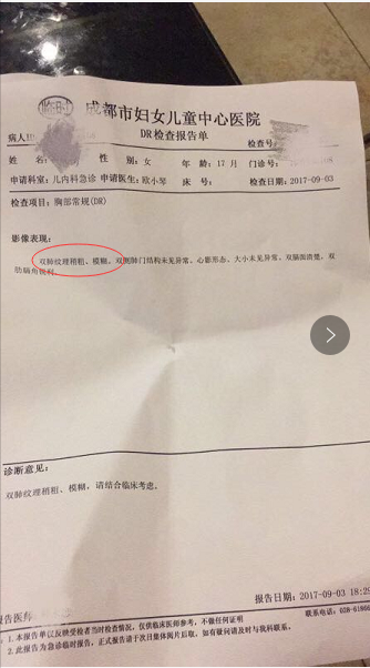 肺炎,全医堂 肺炎,全医堂